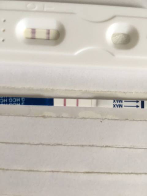 妊娠伴随综合征男性