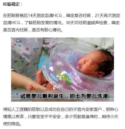 妊娠伴随综合证