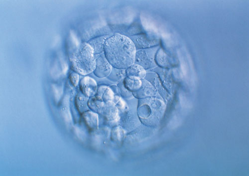 妊辰伴随综合症