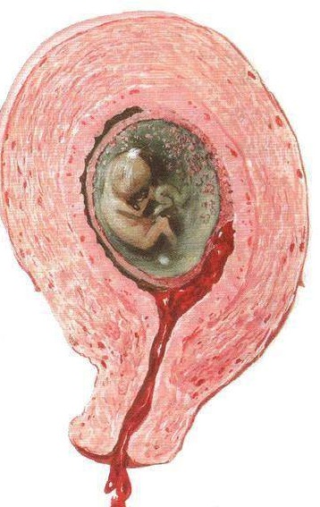 妈妈生日蛋糕文案高级