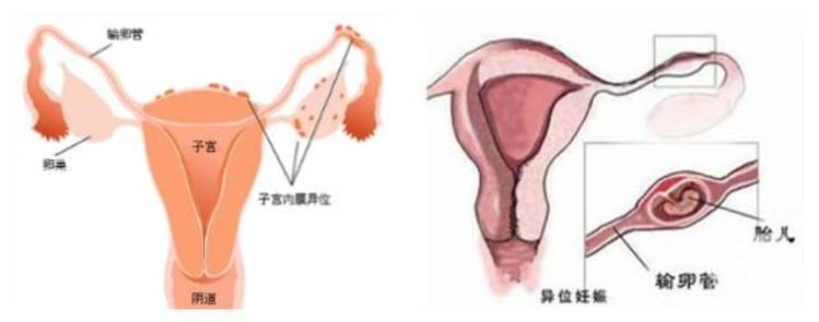 广州做供卵试管多少钱
