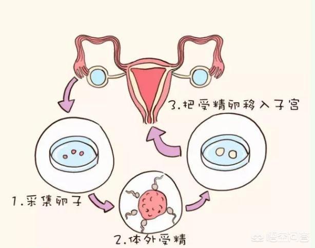 广州供卵助孕私立医院