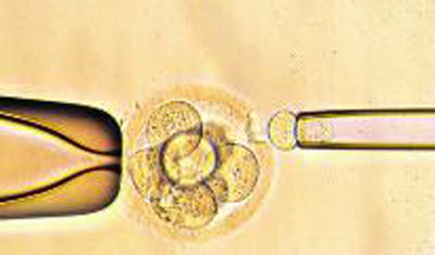 广元捐卵试管生男孩
